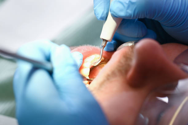 Best Emergency Care for Gum Disease in Dale, IN