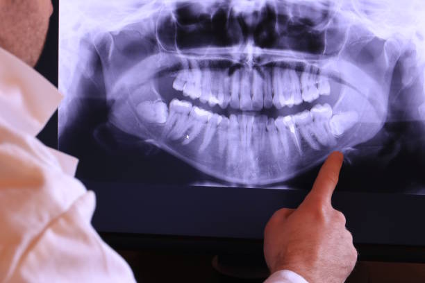 Best Dental Abscess Treatment in Dale, IN